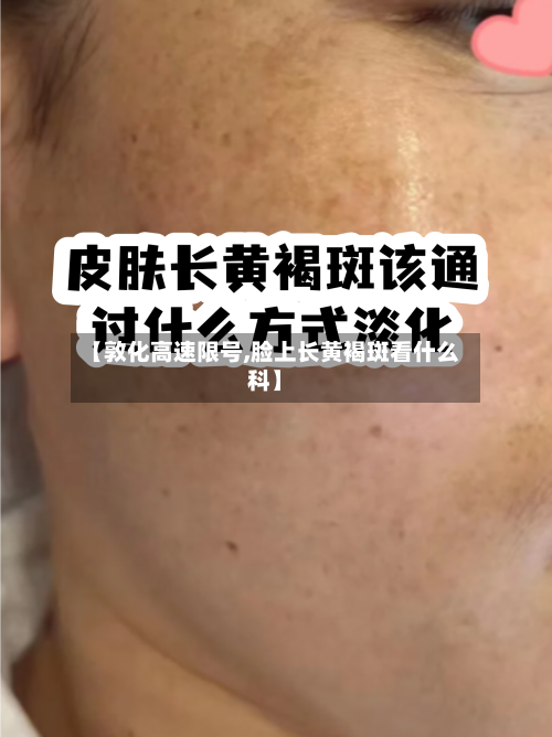 【敦化高速限号,脸上长黄褐斑看什么科】