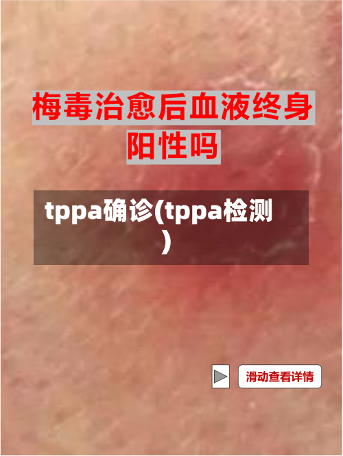 tppa确诊(tppa检测)-第2张图片
