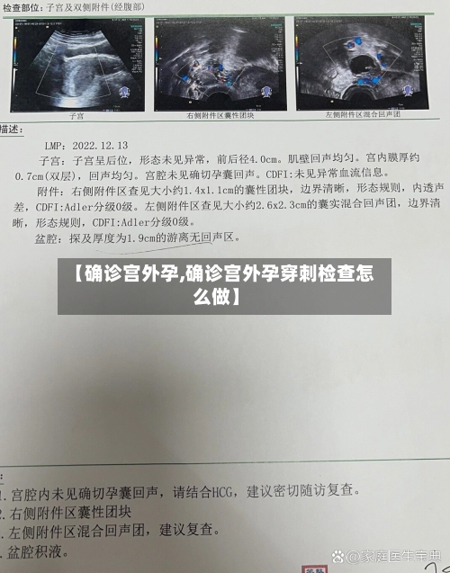 【确诊宫外孕,确诊宫外孕穿刺检查怎么做】