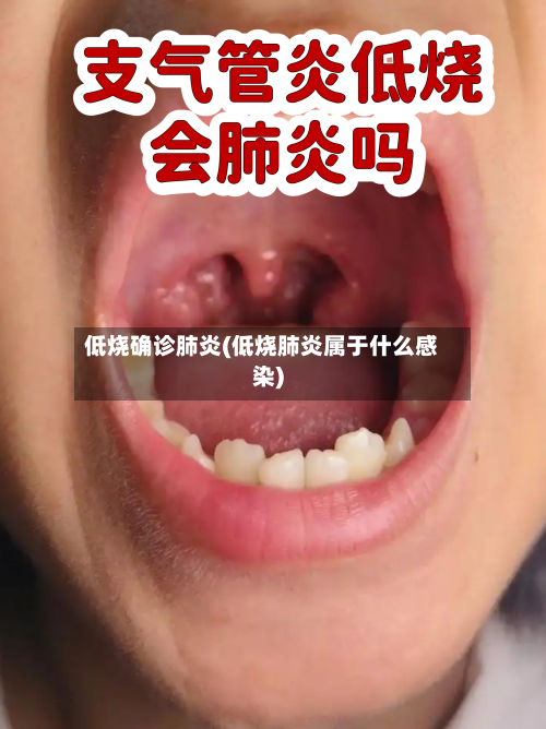 低烧确诊肺炎(低烧肺炎属于什么感染)-第2张图片