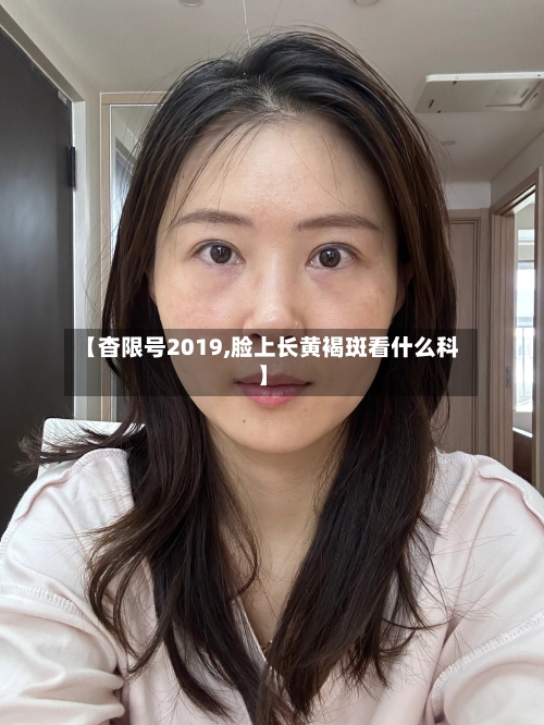 【杳限号2019,脸上长黄褐斑看什么科】