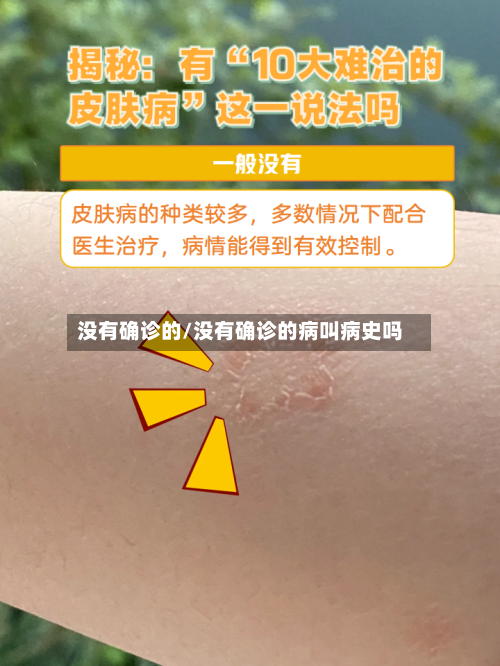 没有确诊的/没有确诊的病叫病史吗-第2张图片