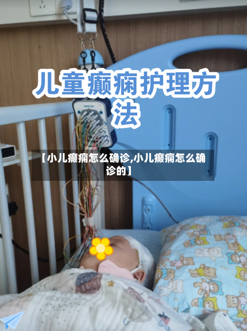【小儿癫痫怎么确诊,小儿癫痫怎么确诊的】-第2张图片