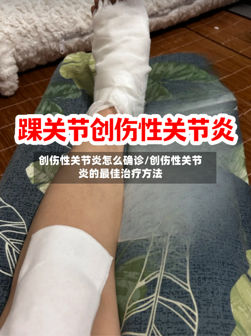 创伤性关节炎怎么确诊/创伤性关节炎的最佳治疗方法-第2张图片