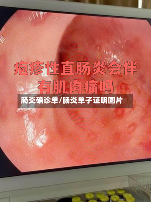 肠炎确诊单/肠炎单子证明图片